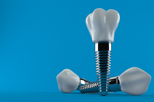 three dental implants against a blue background.