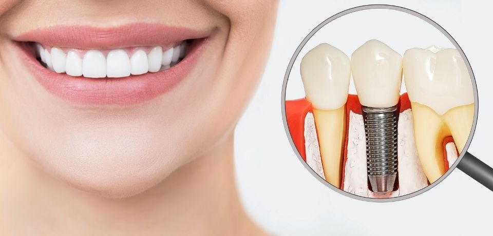 comprehensive dental services