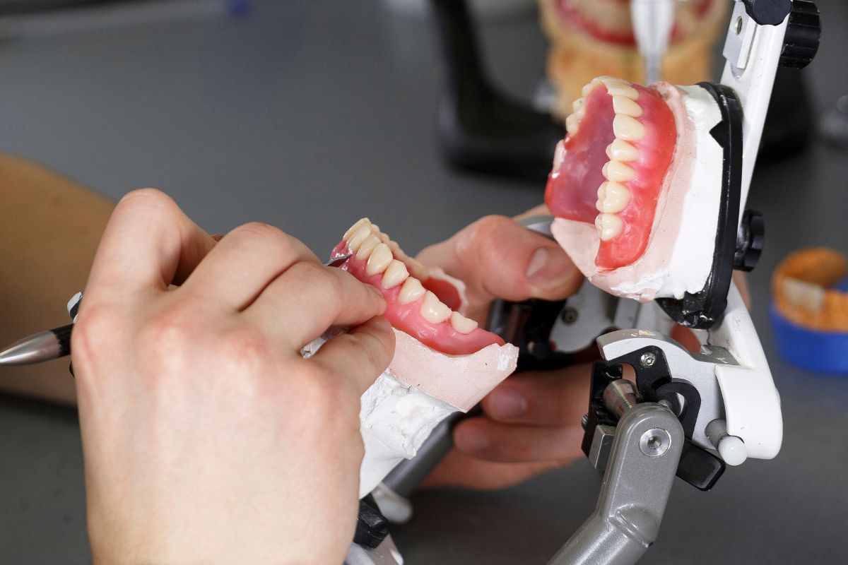 Implants prosthodontist in surrey