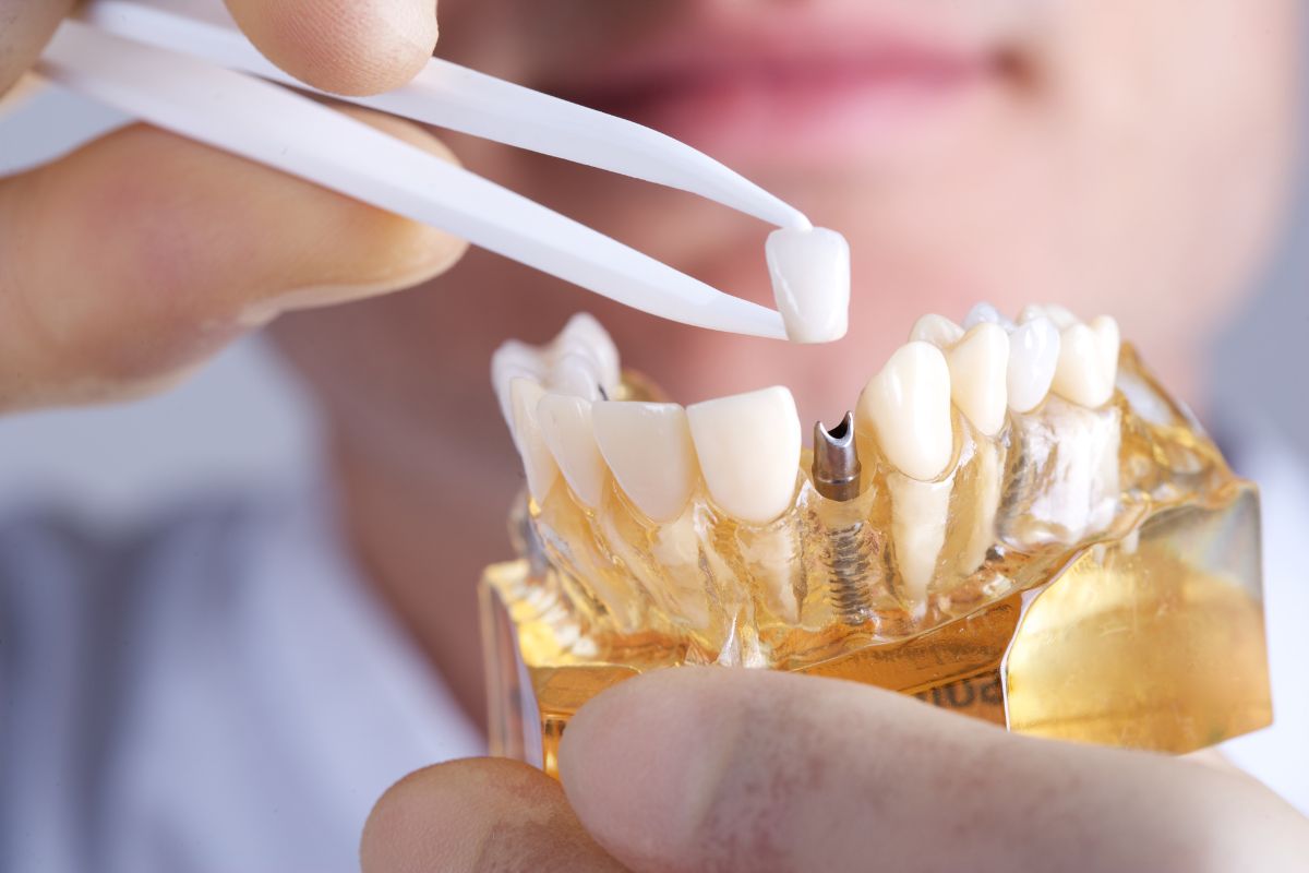Are dental implants painful?