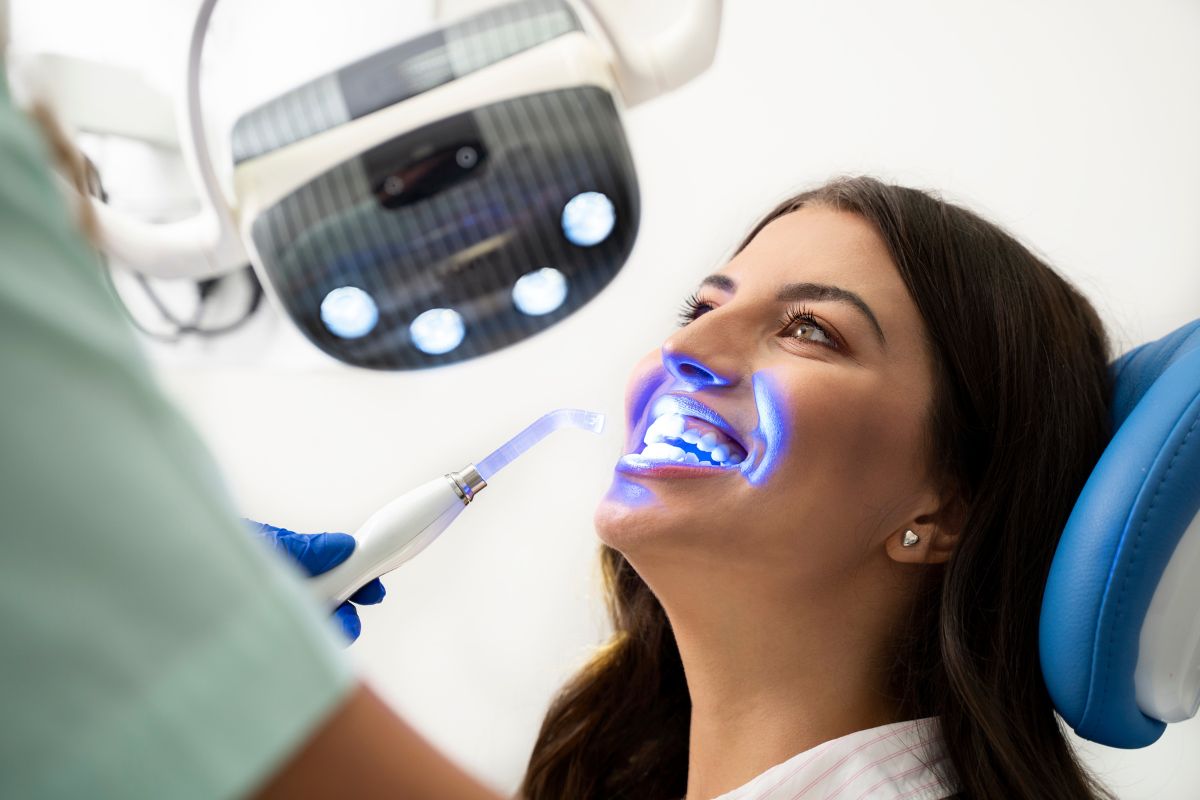 Benefits of Professional Surrey Teeth Whitening