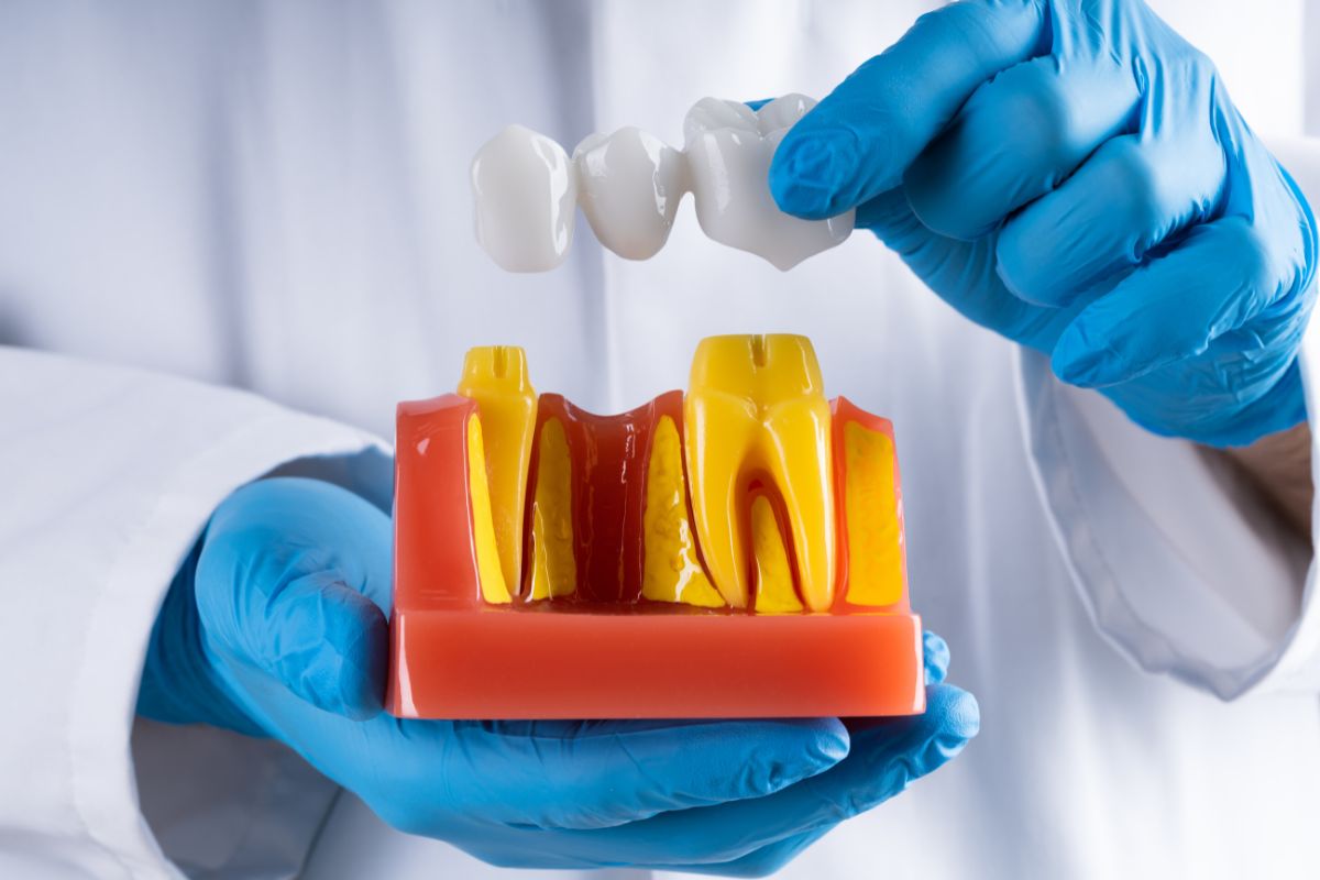 bridge prosthodontist in surrey