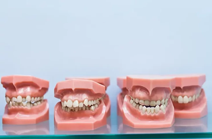 malocclusion surrey