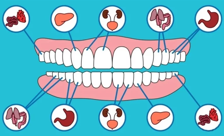 relation between oral health and overall health