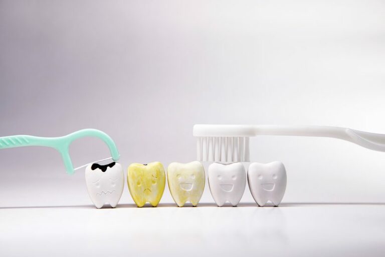tooth-discoloration surrey