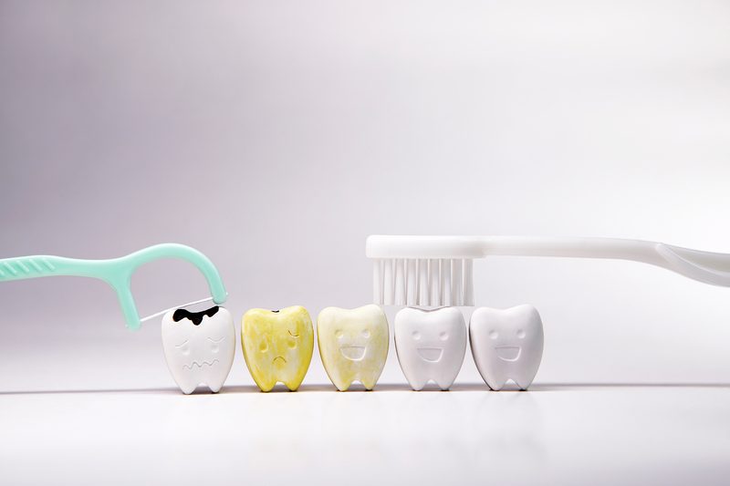 tooth-discoloration surrey