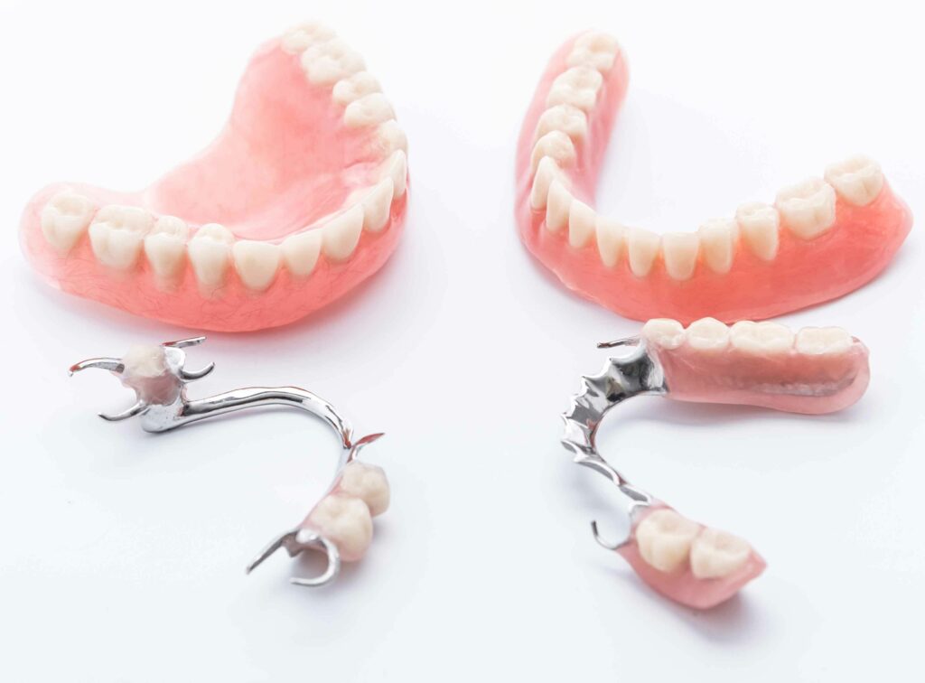 dental prosthesis types