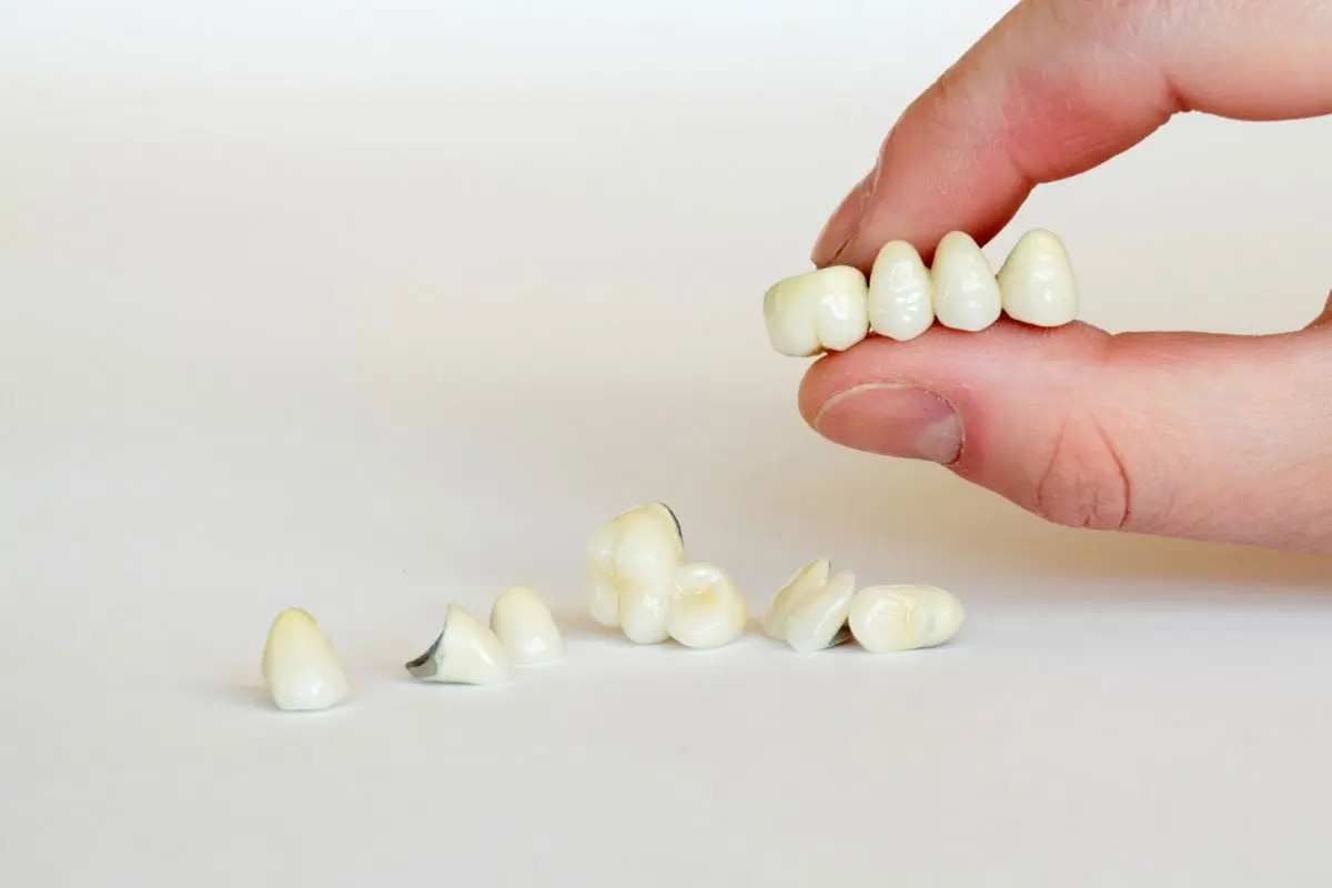 What is Crown in Dentistry