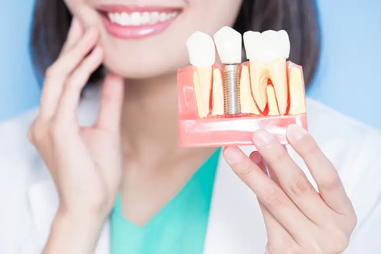 dental implant surrey