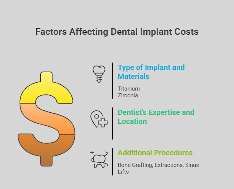 Factors That Affect Dental Implant Pricing