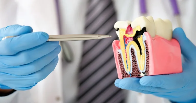 A picture of a dentist demonstrating root canal treatment