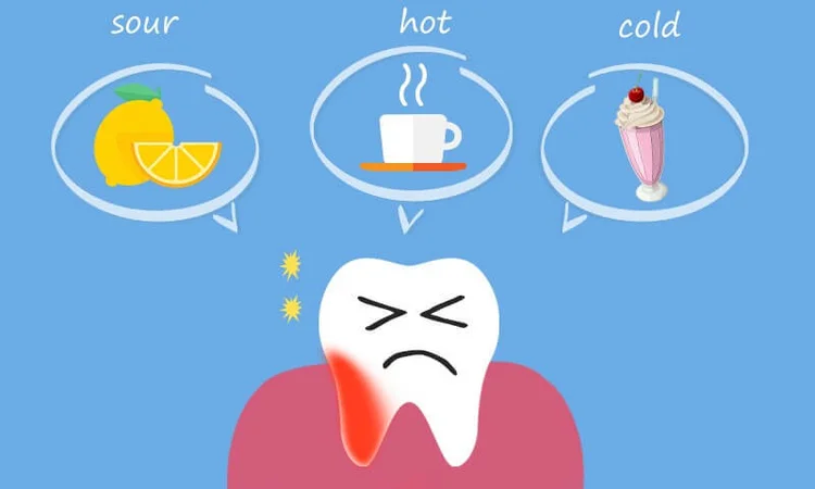 An image demonstrating the foods and drinks that trigger tooth sensitivity