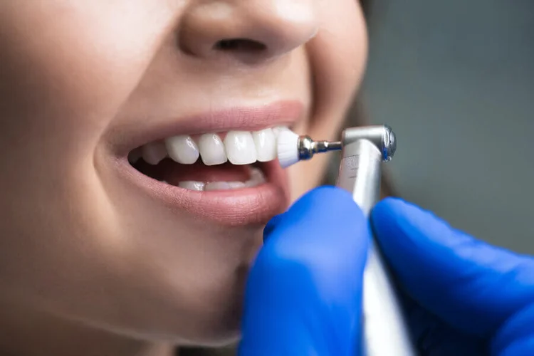 A picture representing teeth cleaning