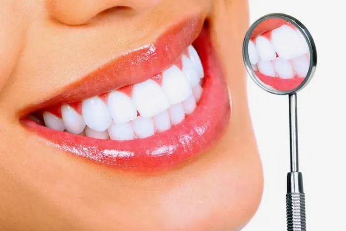 teeth whitening surrey